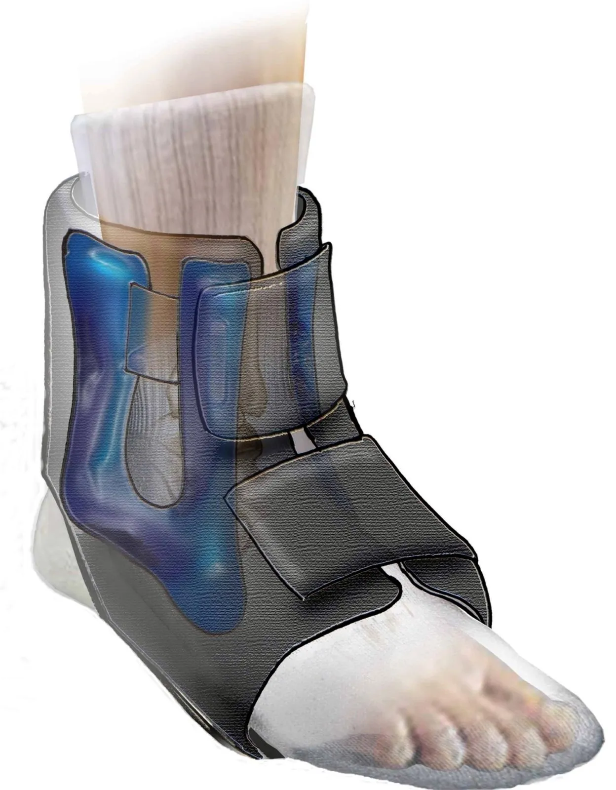 Enkelbrace coolpack Torex