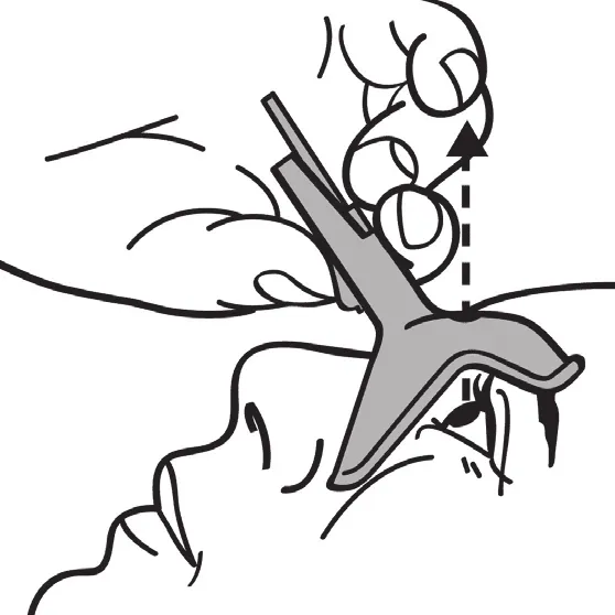 Eyot Minim hoofd achterover buigen