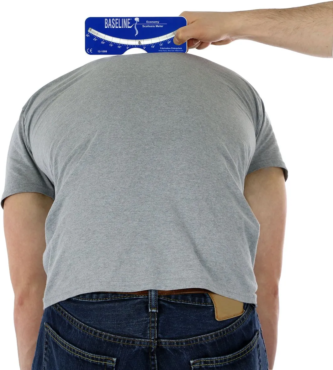 Scoliometer Baseline