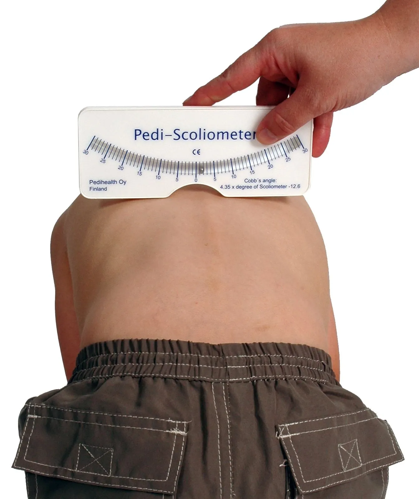 Pedi-Scoliometer