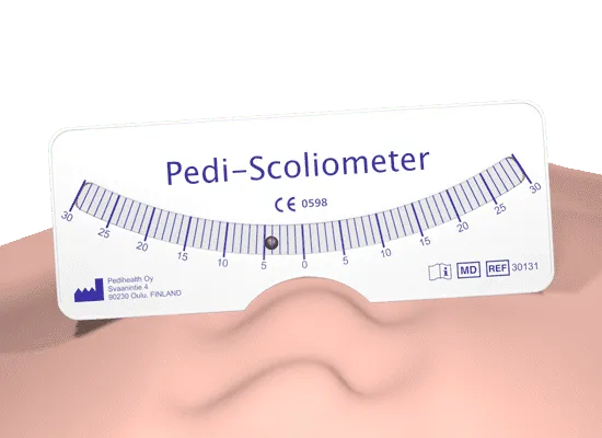Pedi-Scoliometer