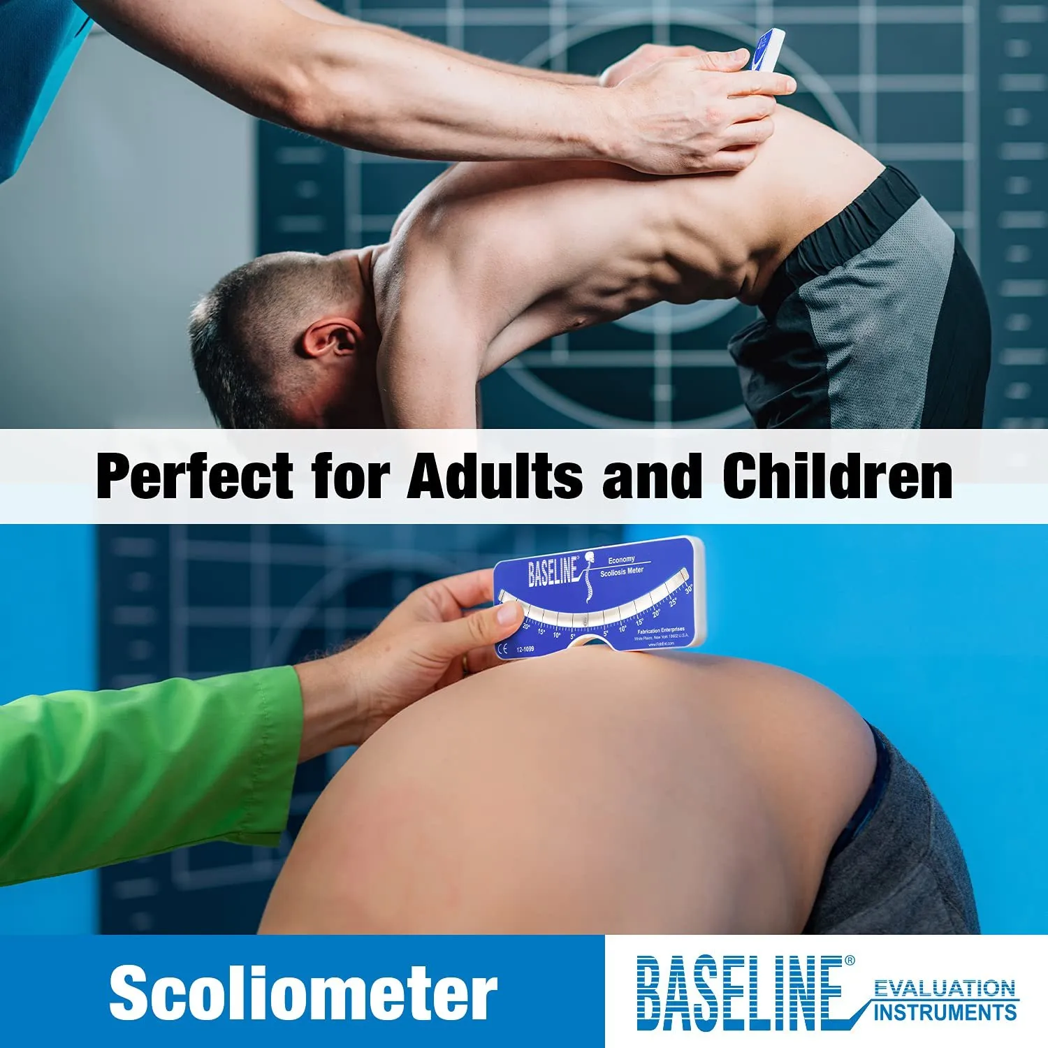 Scoliometer Baseline