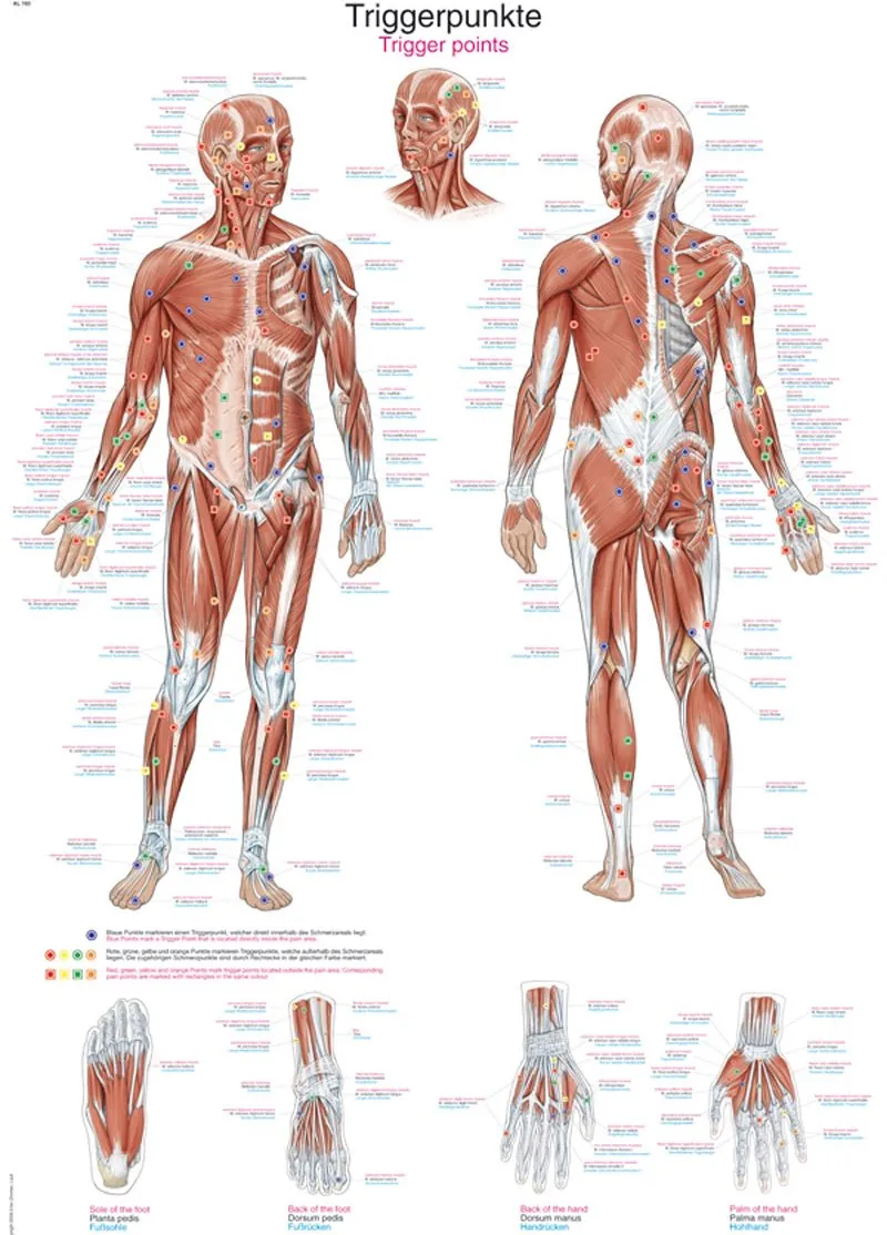 Anatomie poster Triggerpoints Groot 70 x 100 cm